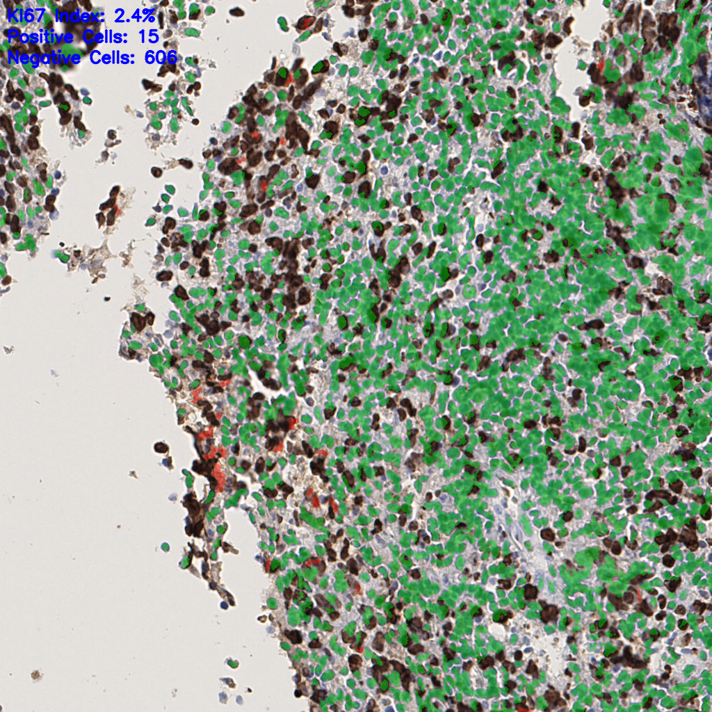 slice_41_6_x36736_y5376.png