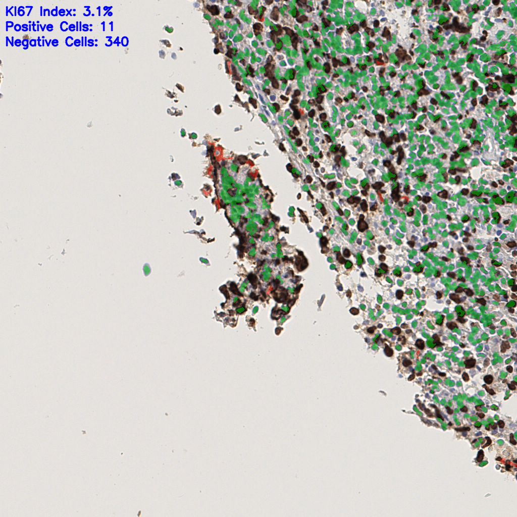 slice_41_7_x36736_y6272.png
