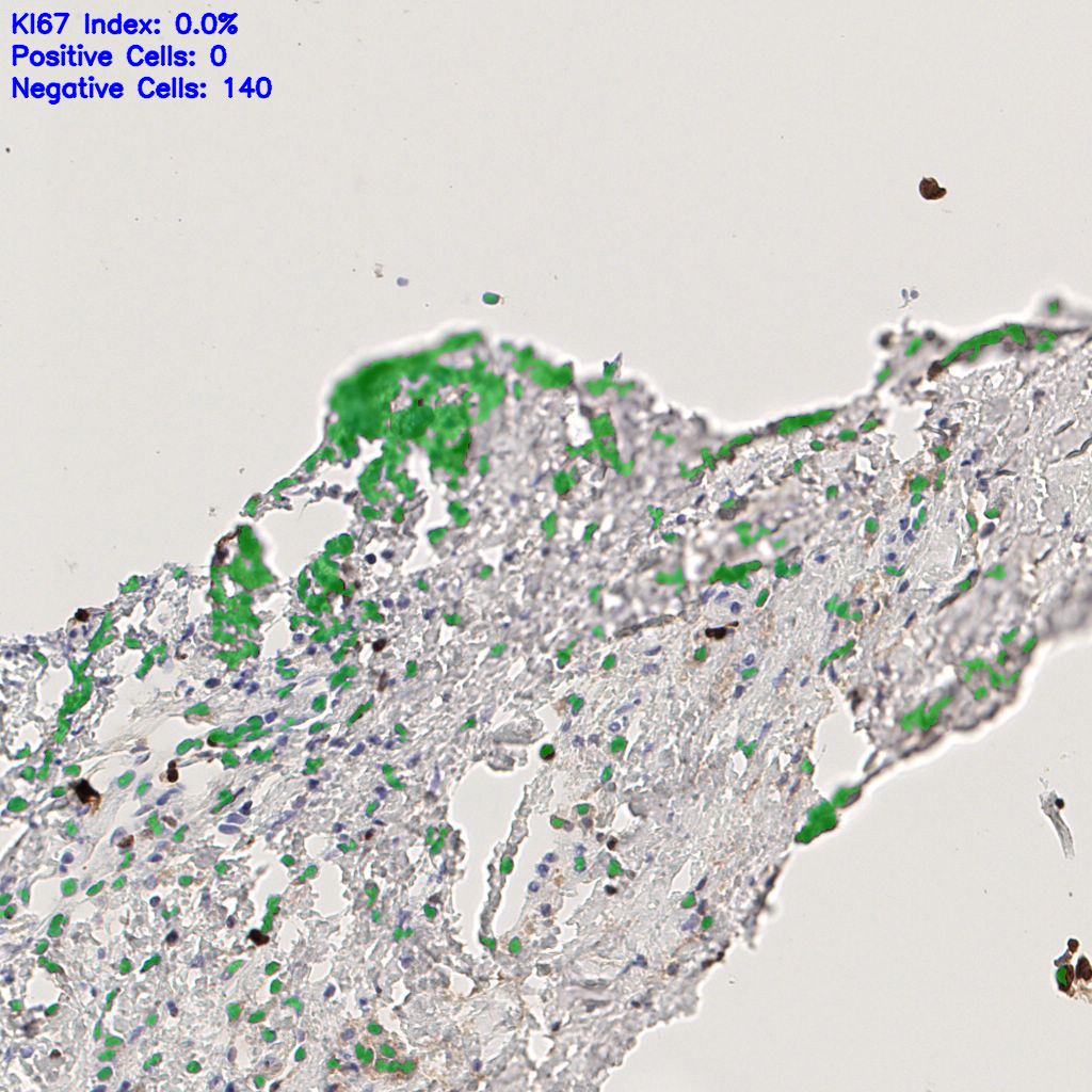 slice_42_12_x37632_y10752.png