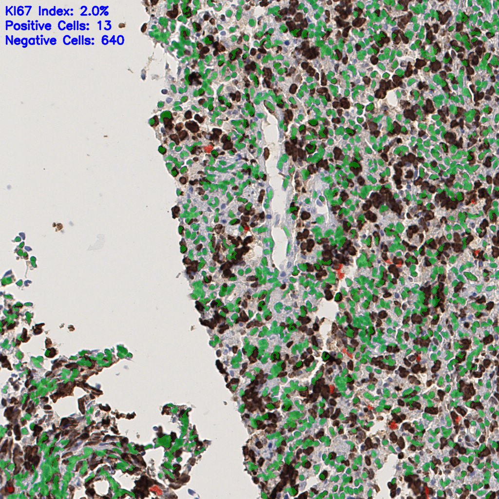 slice_42_5_x37632_y4480.png