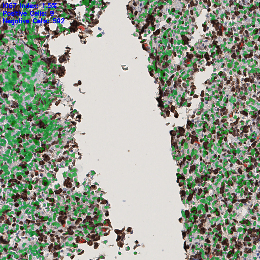 slice_42_6_x37632_y5376.png