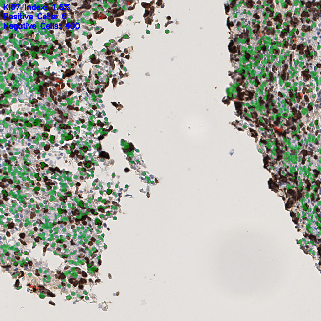 slice_42_7_x37632_y6272.png