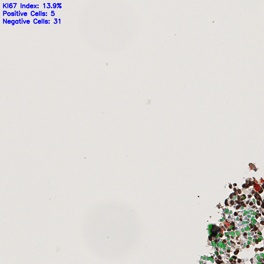 slice_43_2_x38528_y1792.png