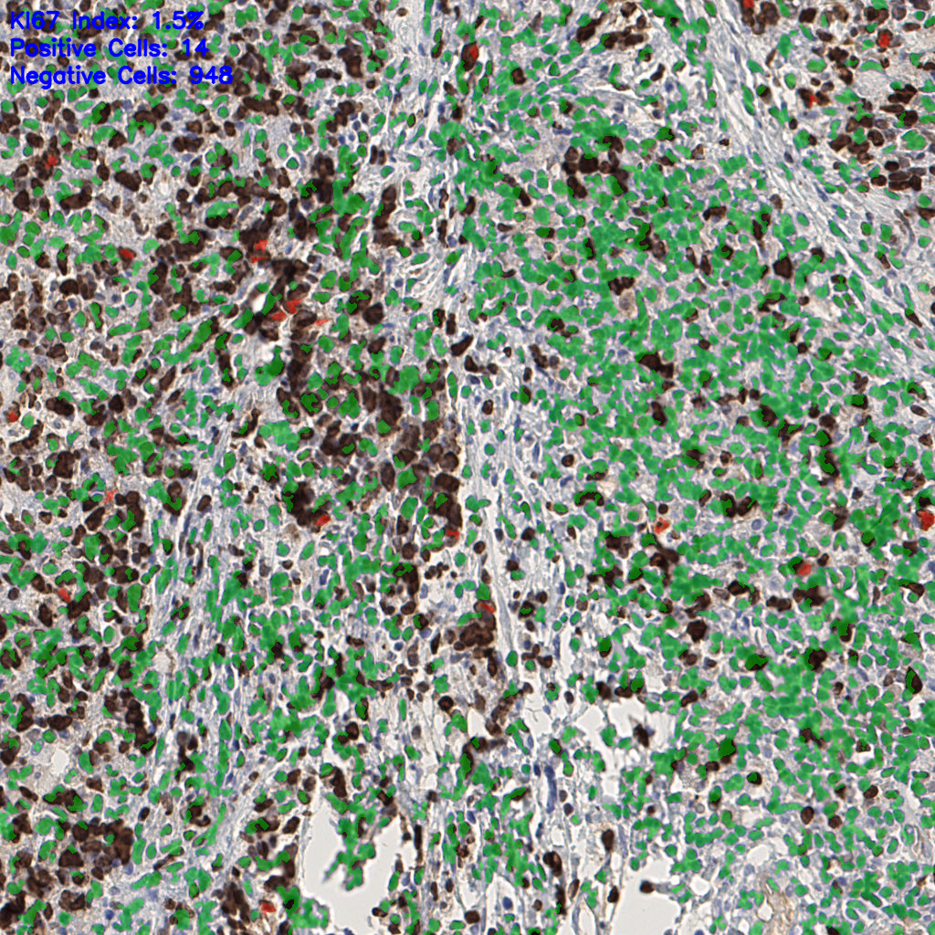 slice_43_6_x38528_y5376.png