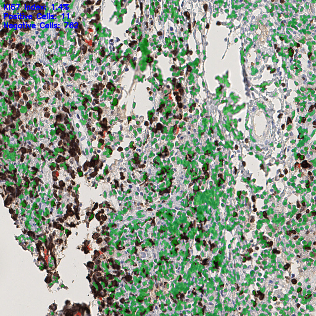 slice_43_7_x38528_y6272.png