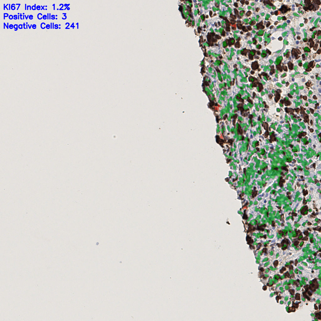 slice_43_9_x38528_y8064.png