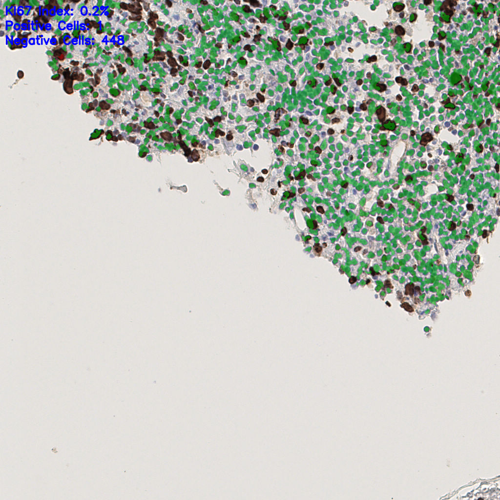 slice_44_10_x39424_y8960.png