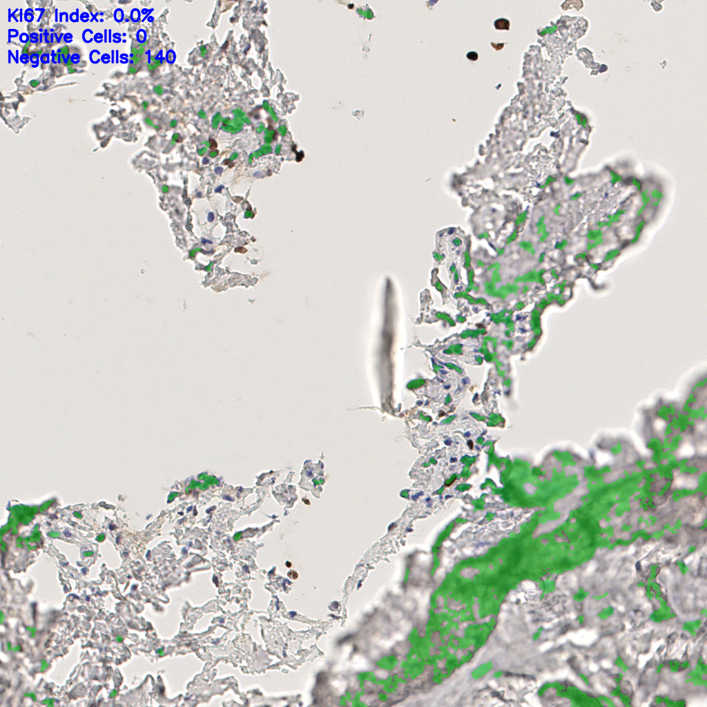 slice_44_12_x39424_y10752.png