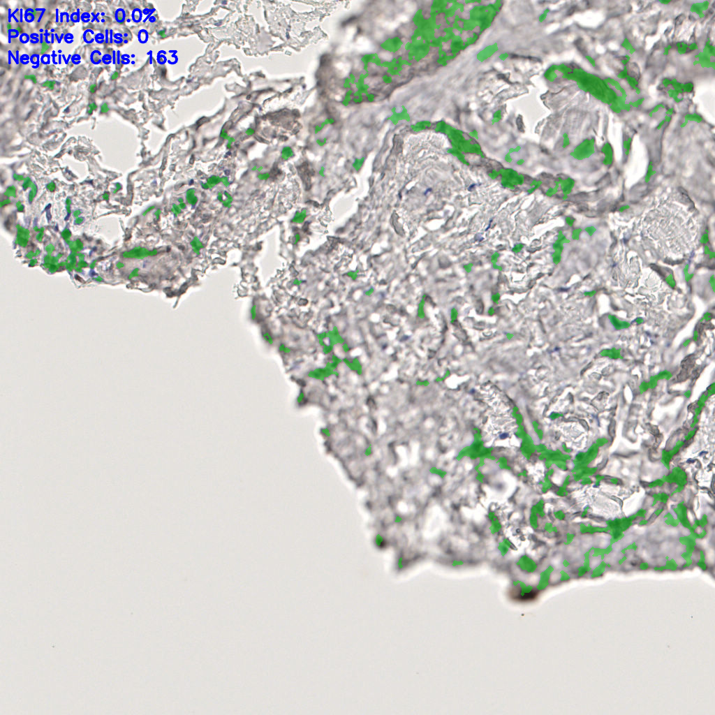 slice_44_13_x39424_y11648.png