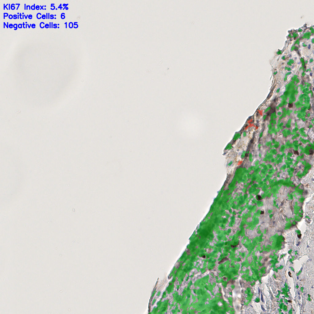 slice_44_17_x39424_y15232.png