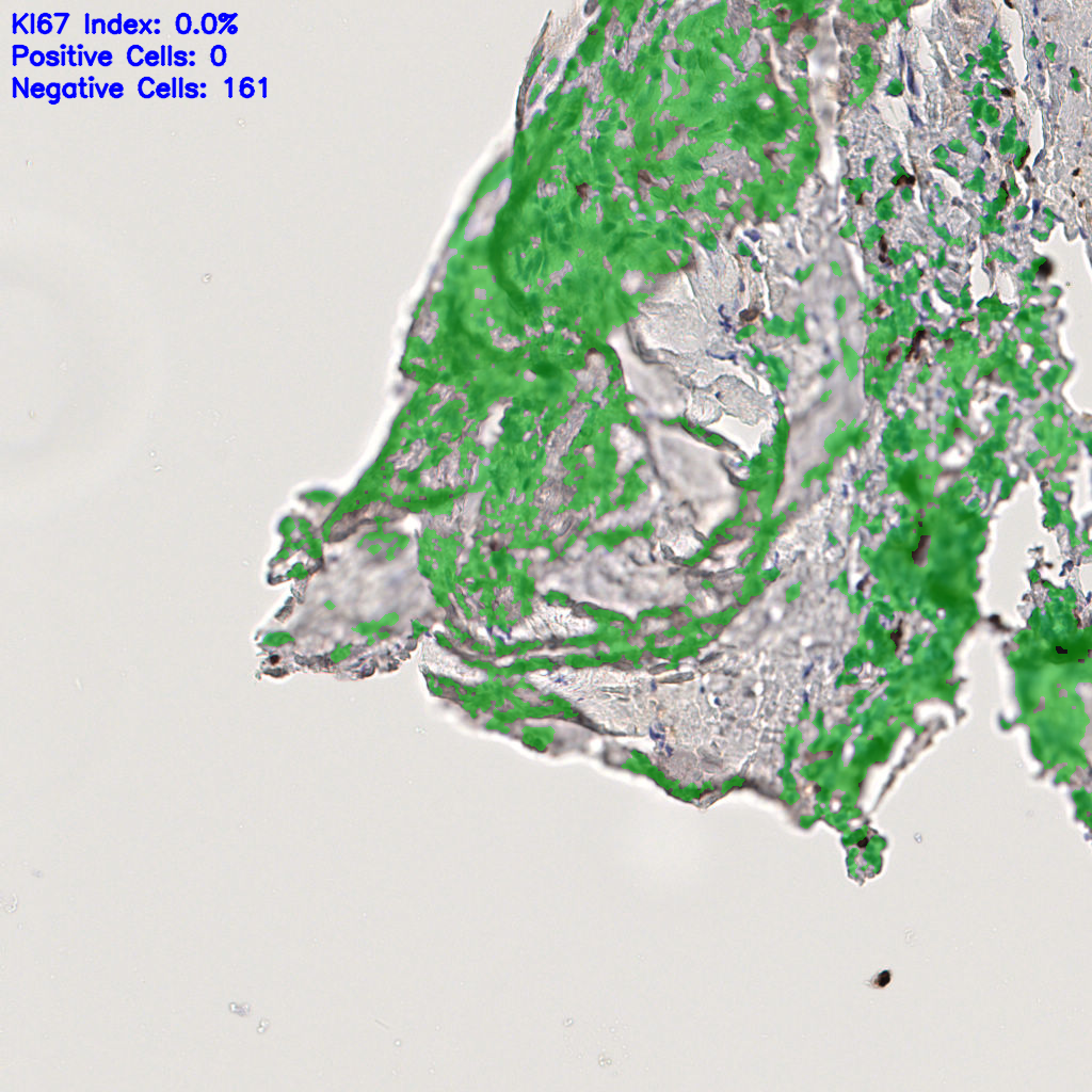 slice_44_18_x39424_y16128.png