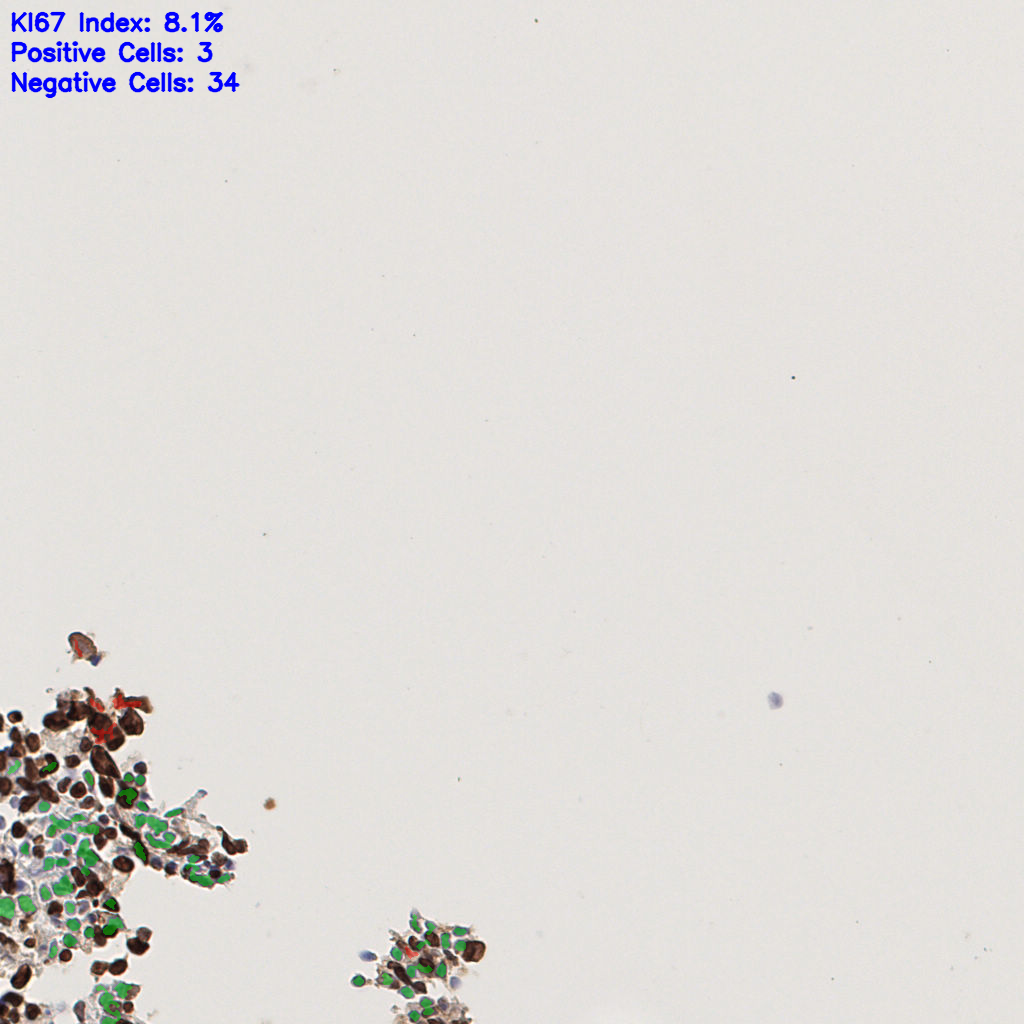 slice_44_2_x39424_y1792.png