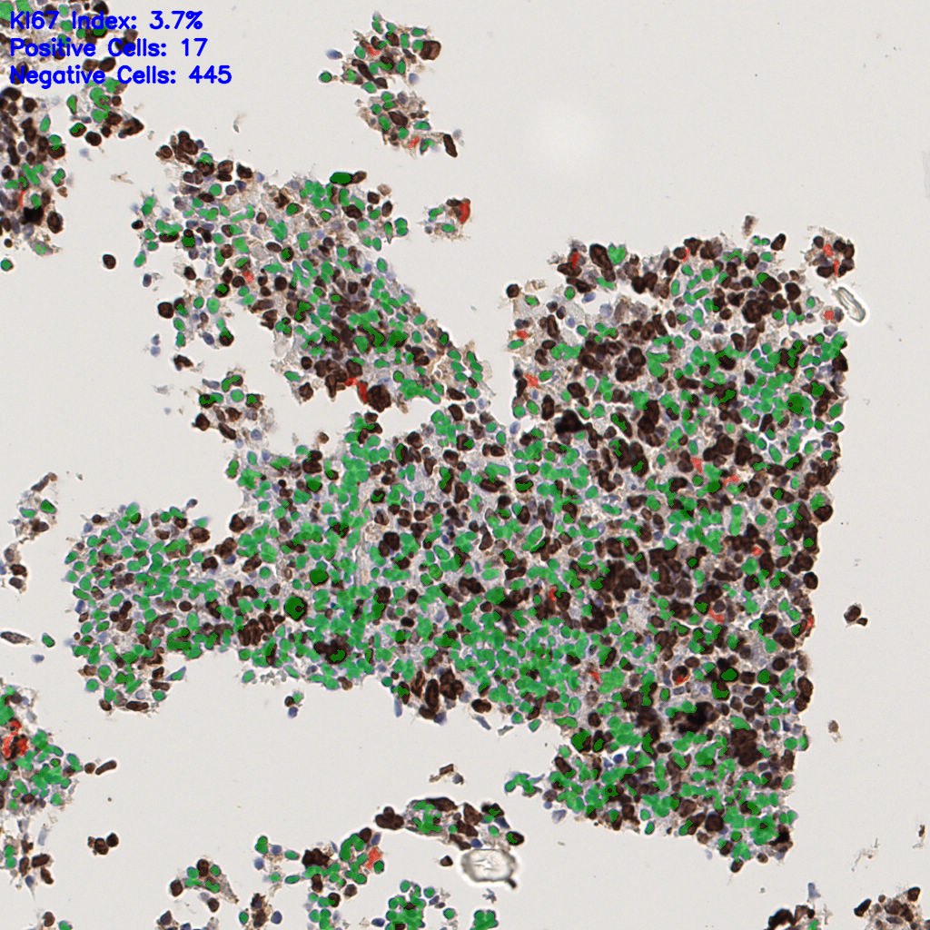 slice_44_3_x39424_y2688.png
