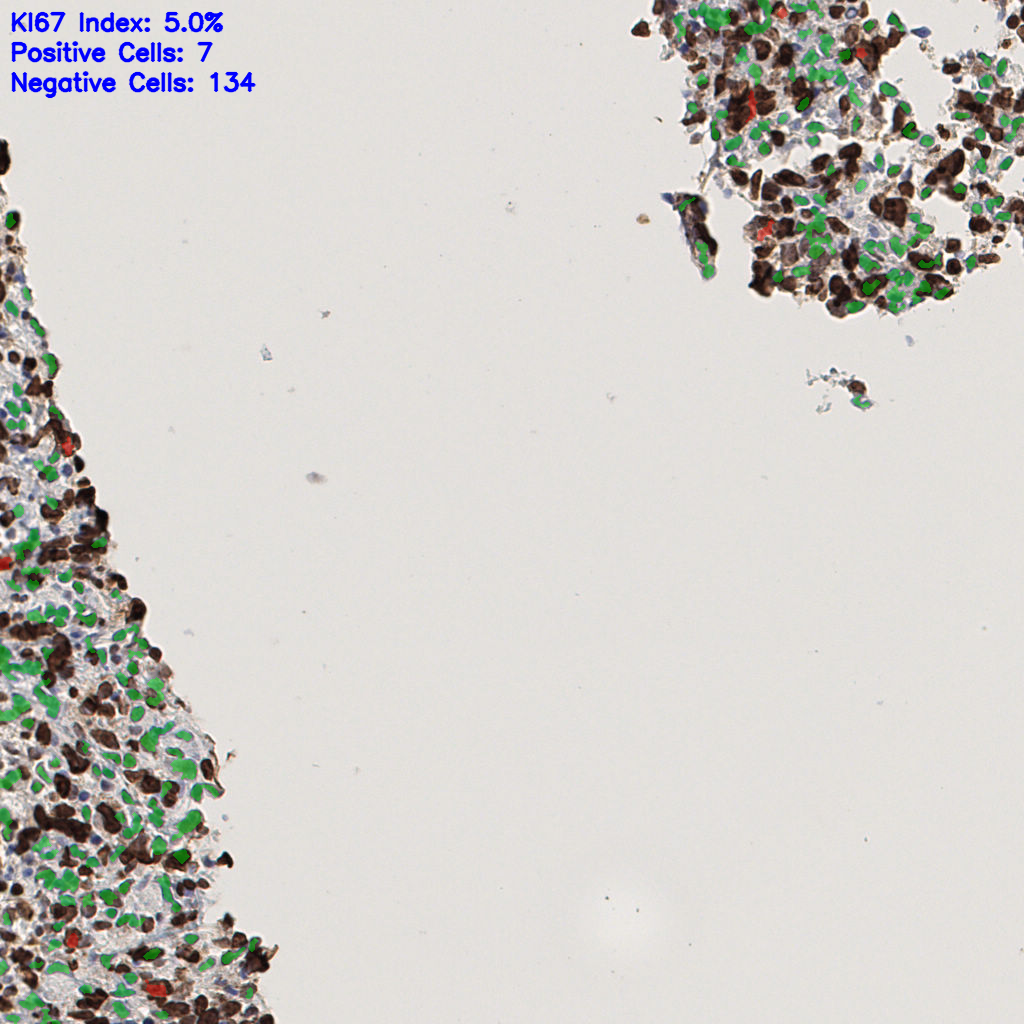 slice_44_5_x39424_y4480.png