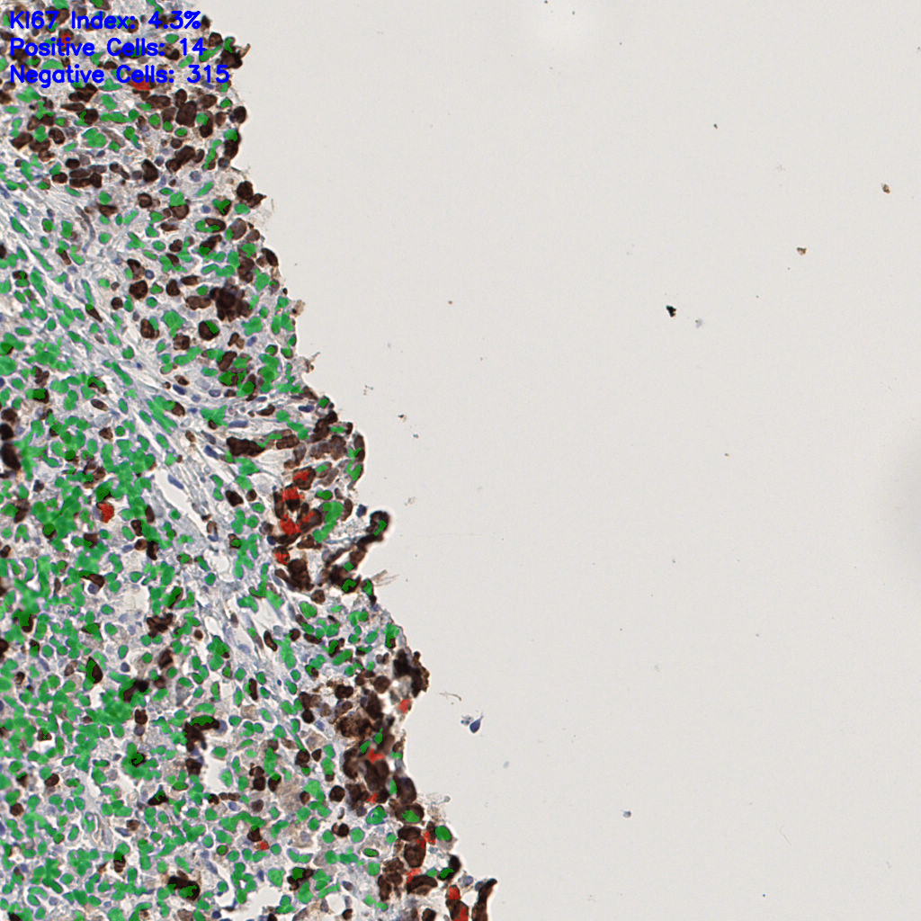 slice_44_6_x39424_y5376.png