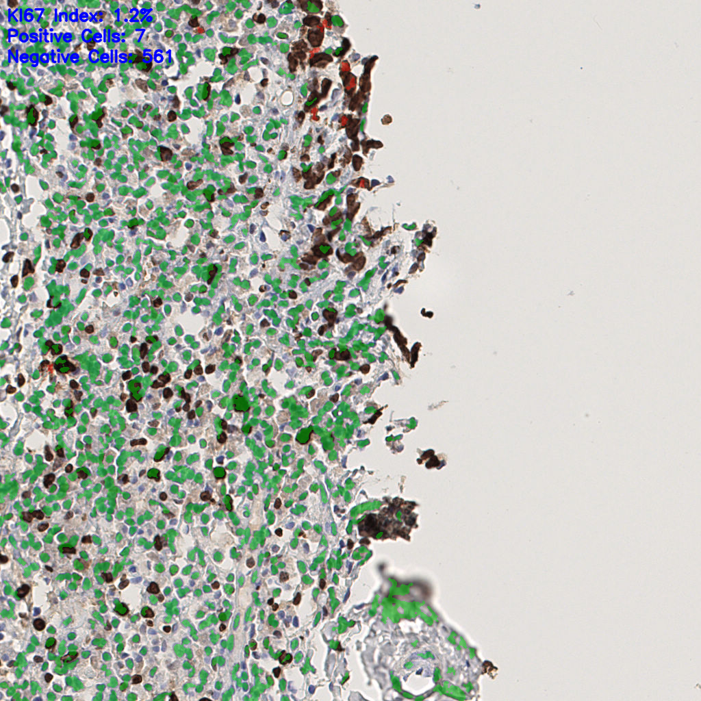 slice_44_7_x39424_y6272.png