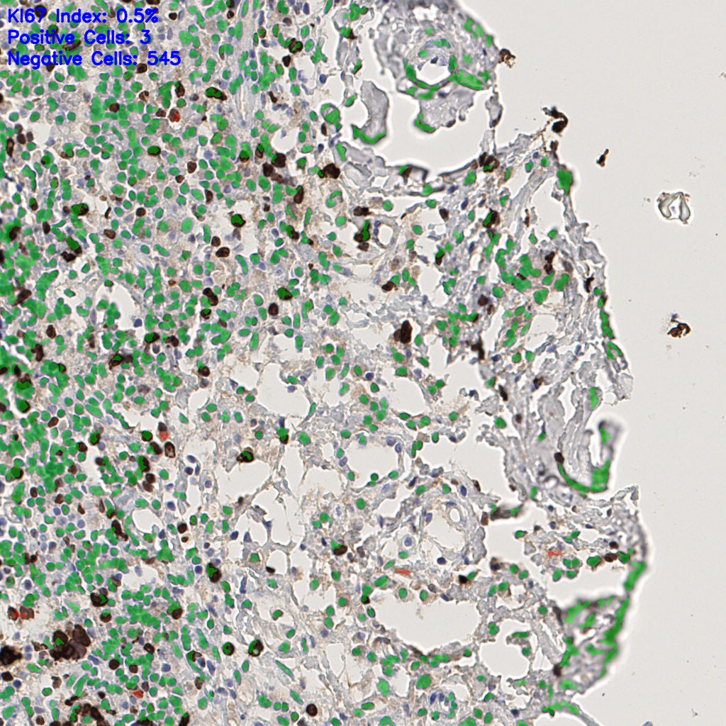 slice_44_8_x39424_y7168.png