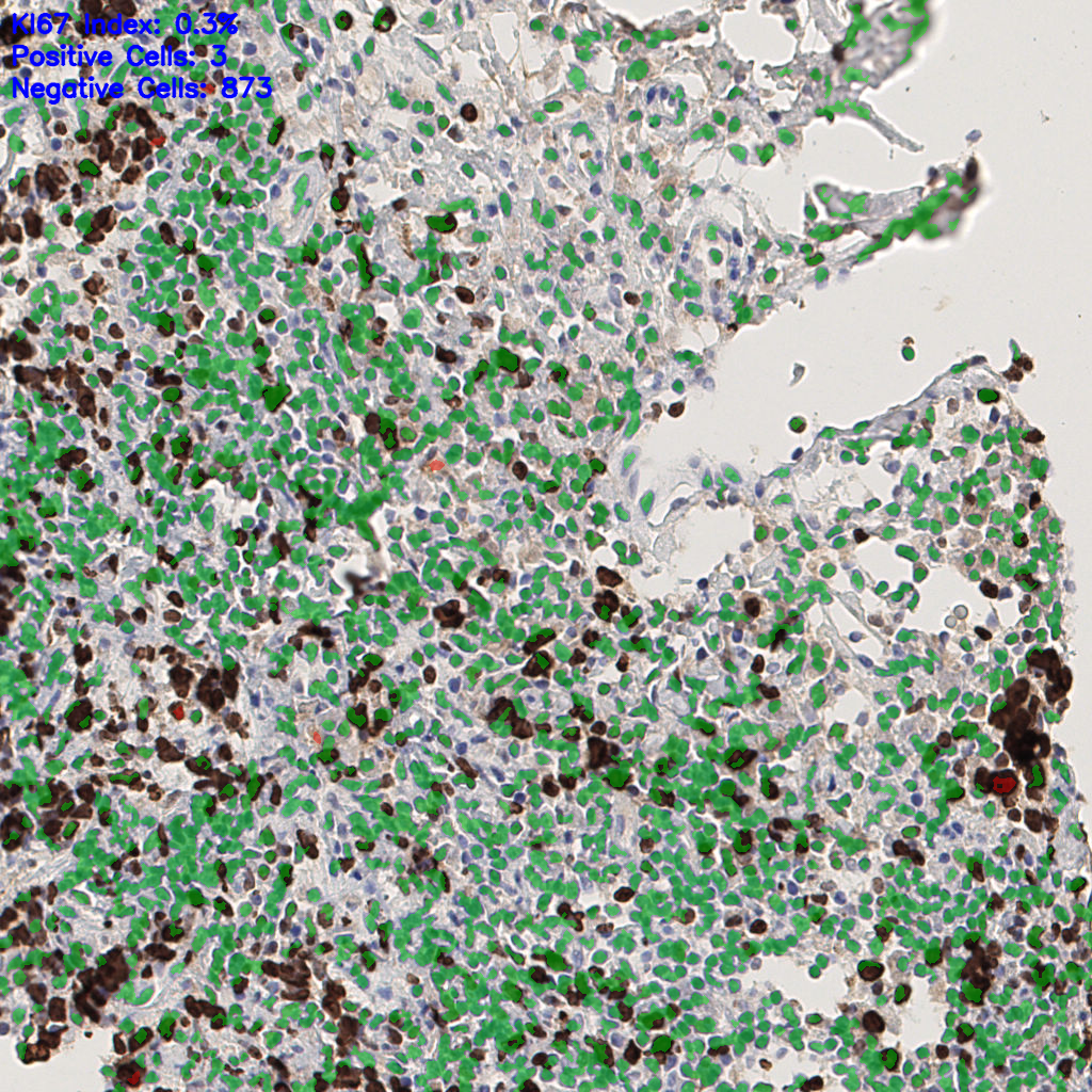 slice_44_9_x39424_y8064.png
