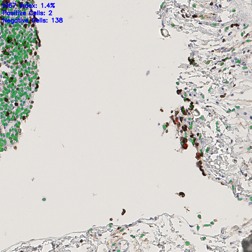 slice_45_10_x40320_y8960.png