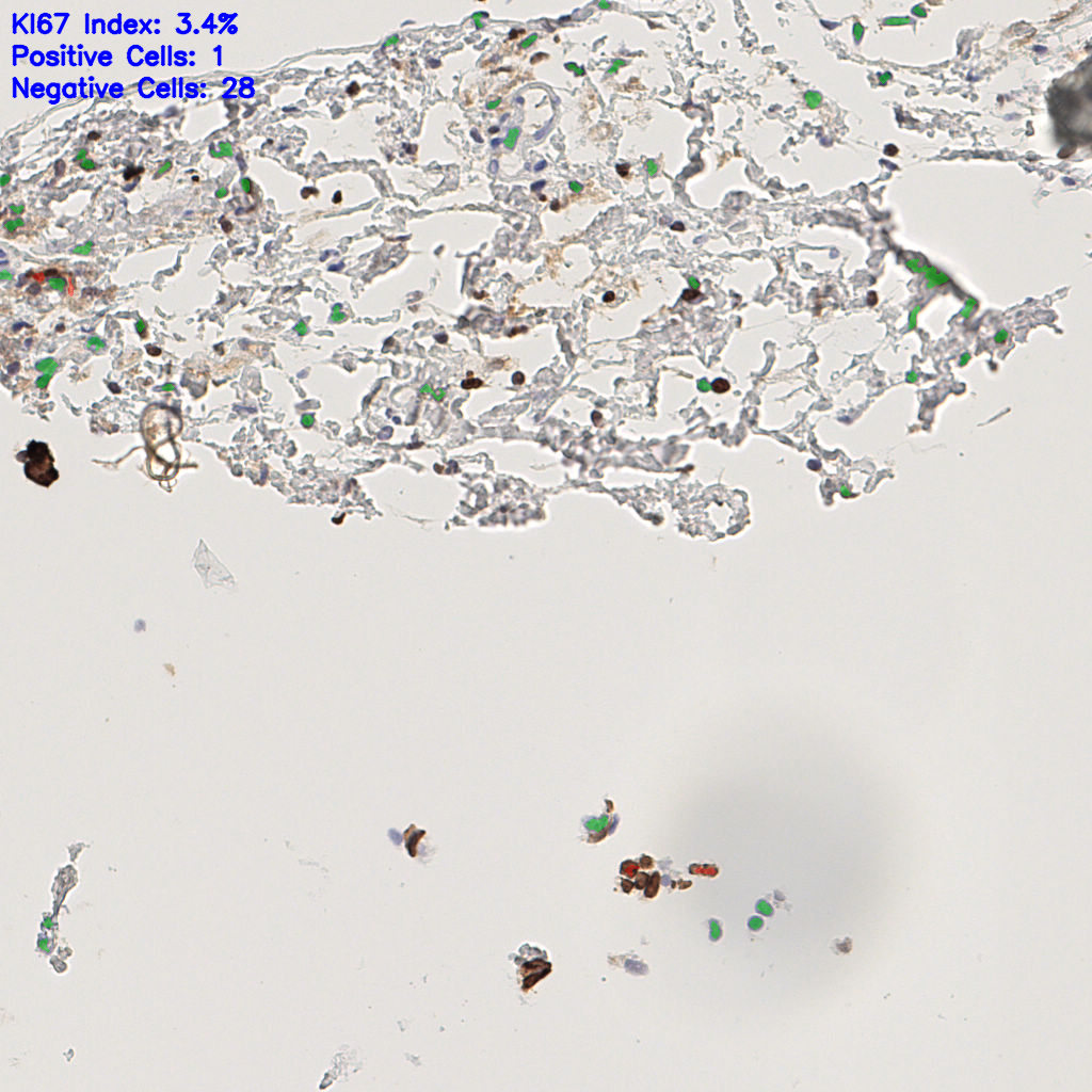 slice_45_11_x40320_y9856.png