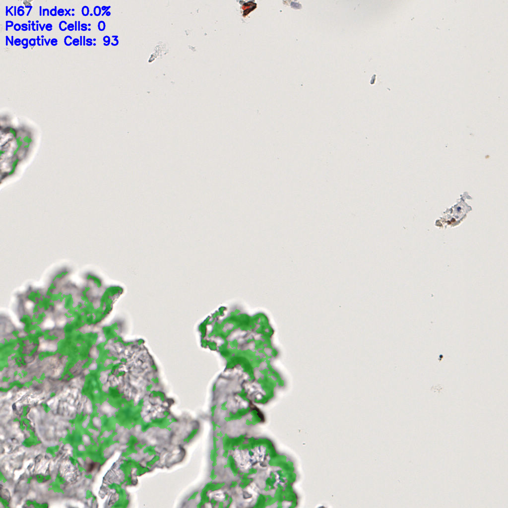 slice_45_12_x40320_y10752.png