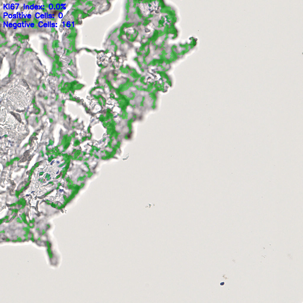 slice_45_13_x40320_y11648.png