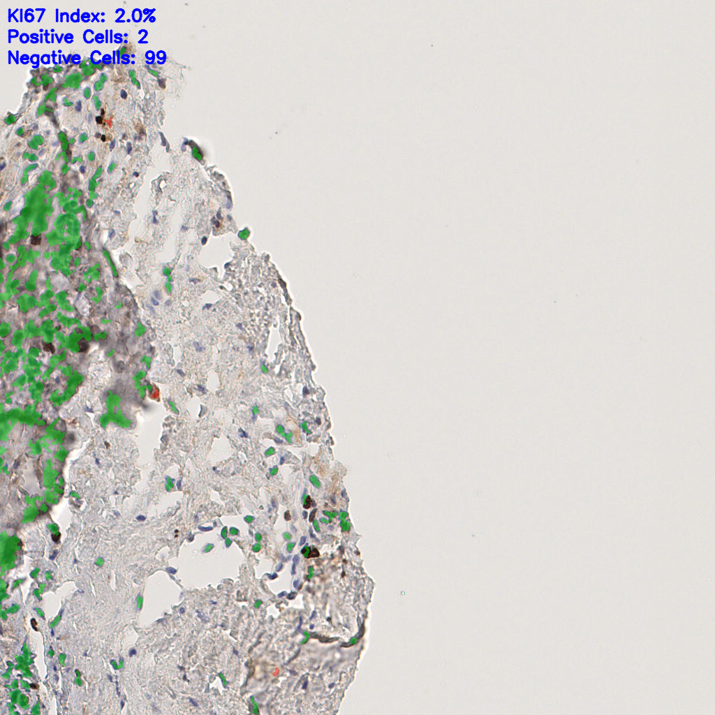 slice_45_17_x40320_y15232.png