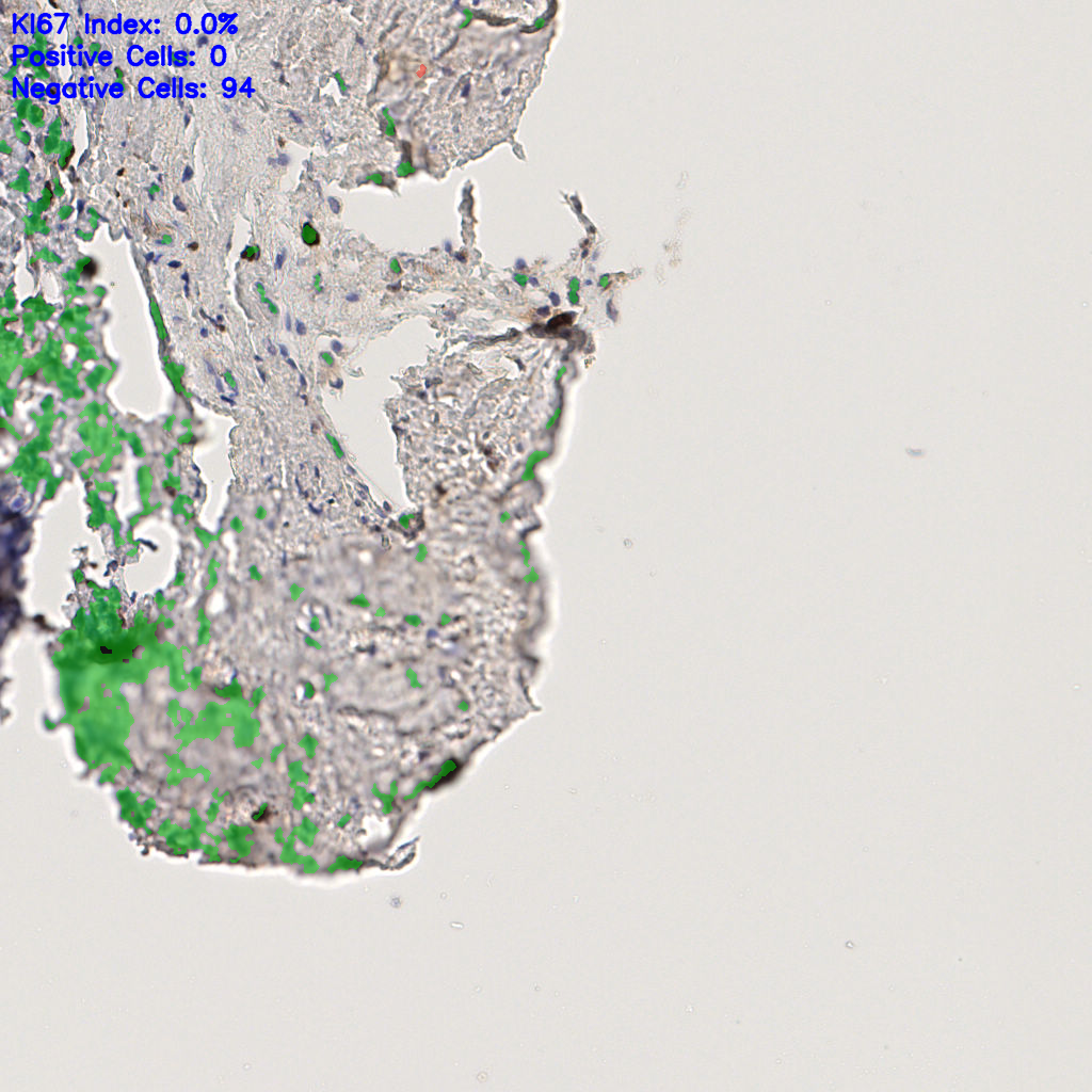 slice_45_18_x40320_y16128.png