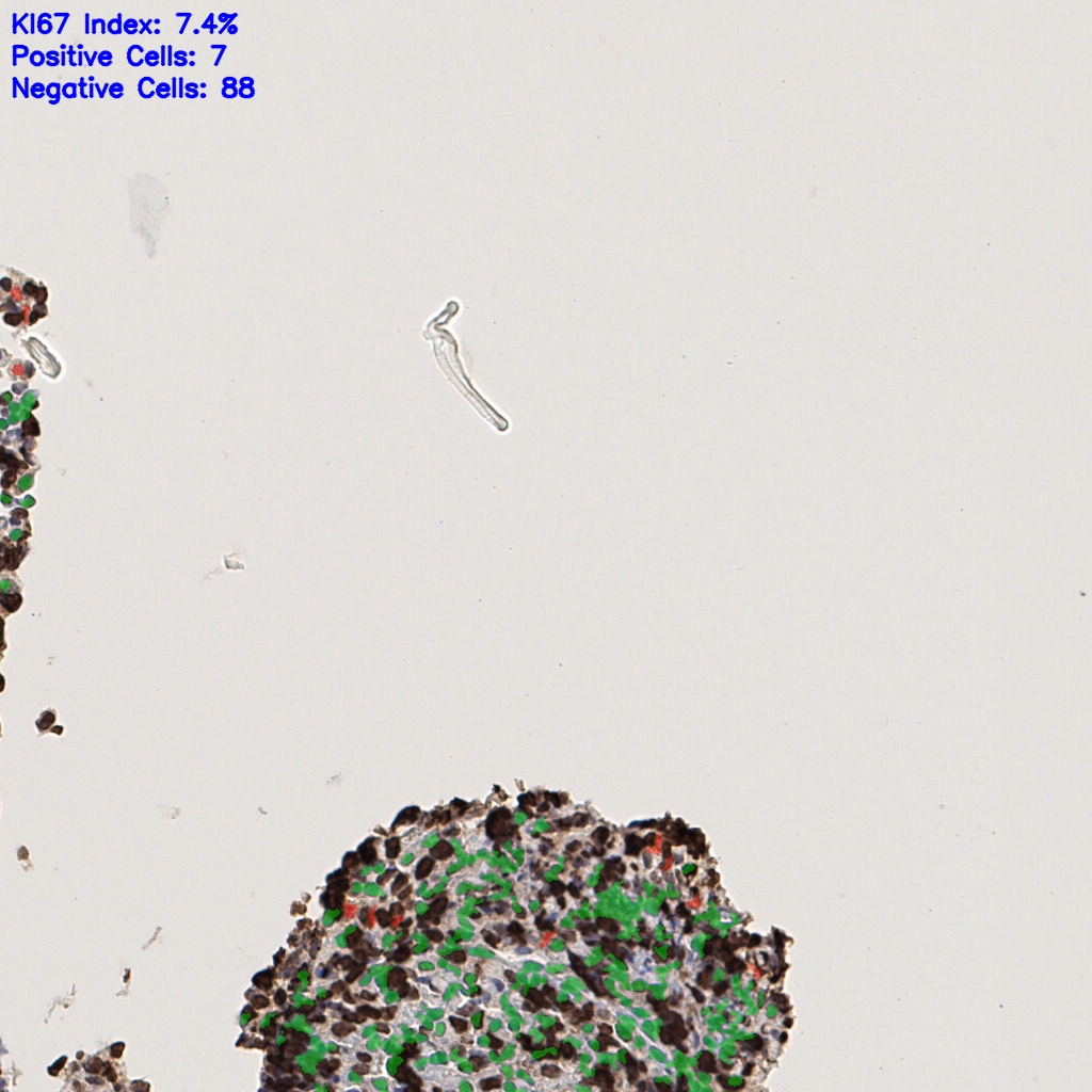 slice_45_3_x40320_y2688.png