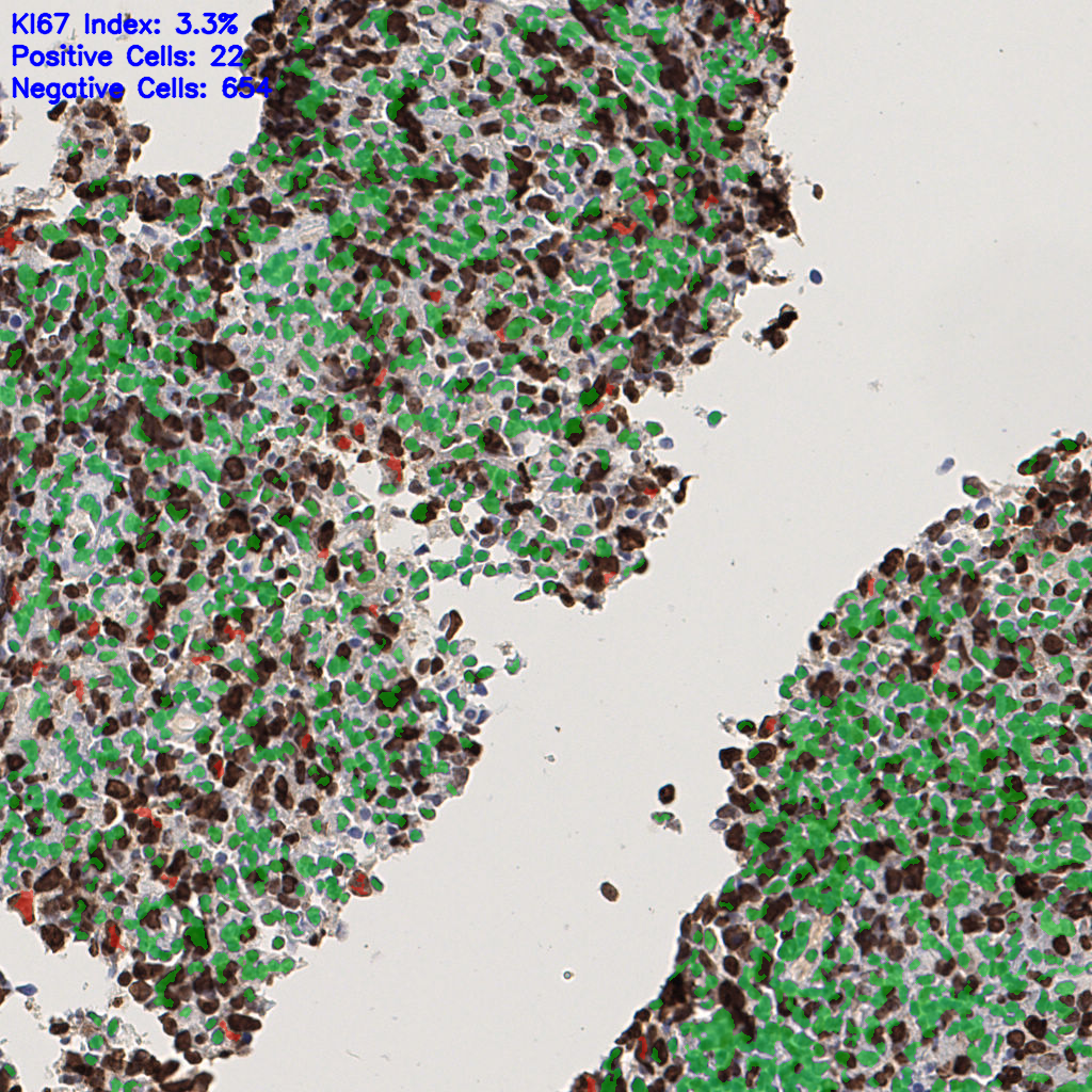 slice_45_4_x40320_y3584.png