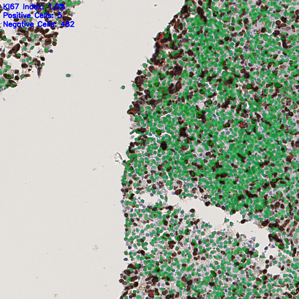 slice_45_5_x40320_y4480.png