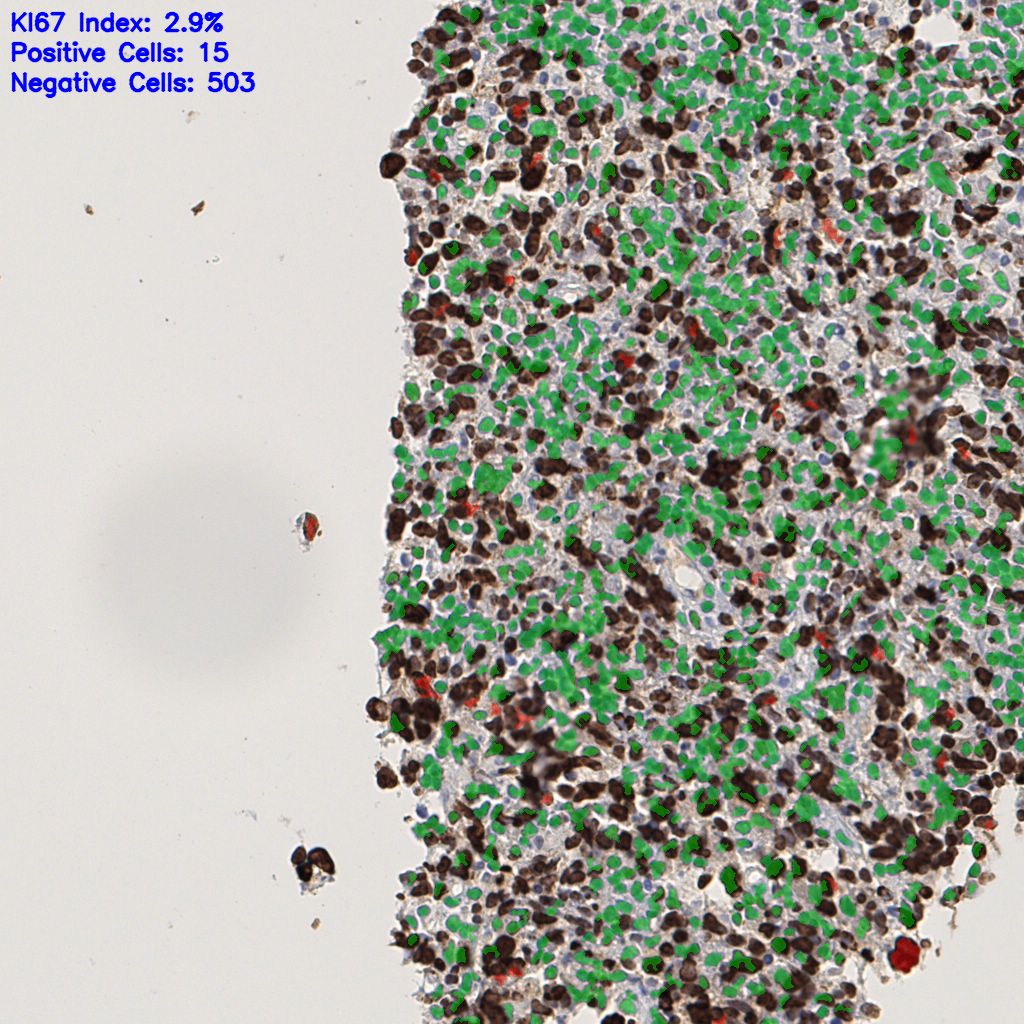 slice_45_6_x40320_y5376.png