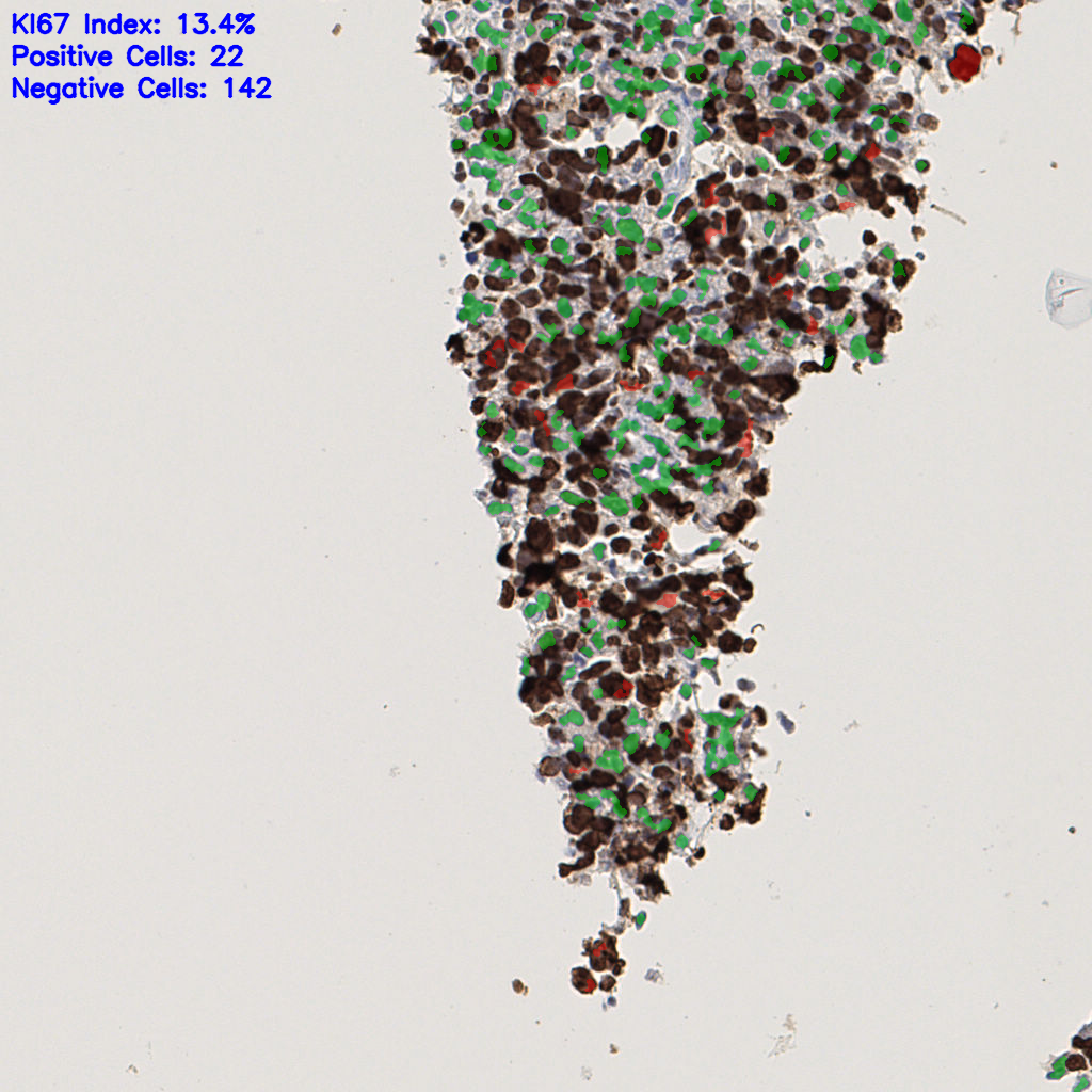 slice_45_7_x40320_y6272.png