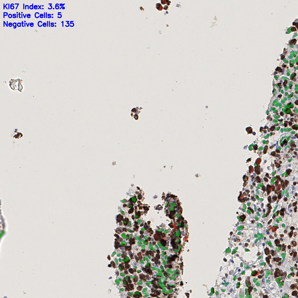 slice_45_8_x40320_y7168.png