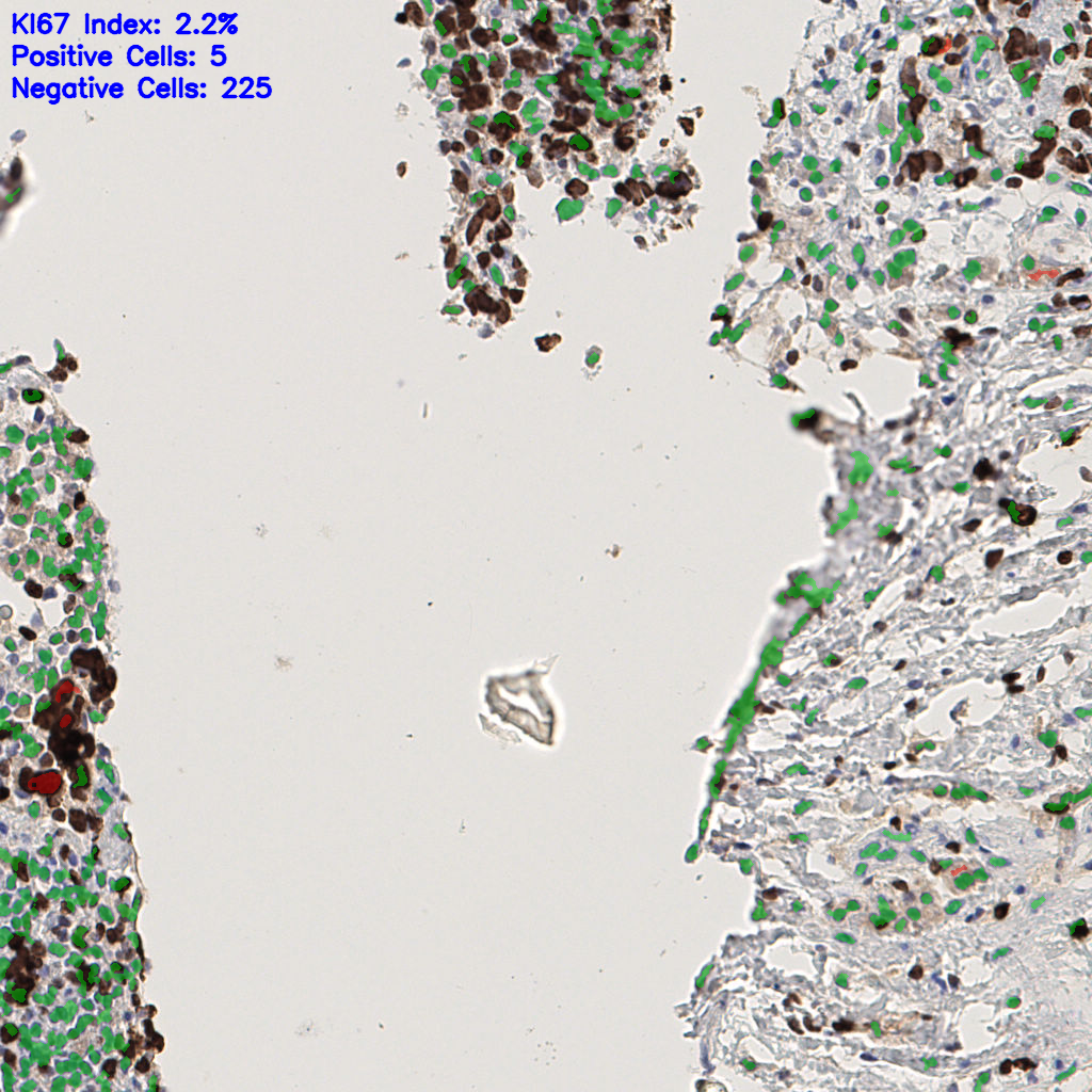 slice_45_9_x40320_y8064.png