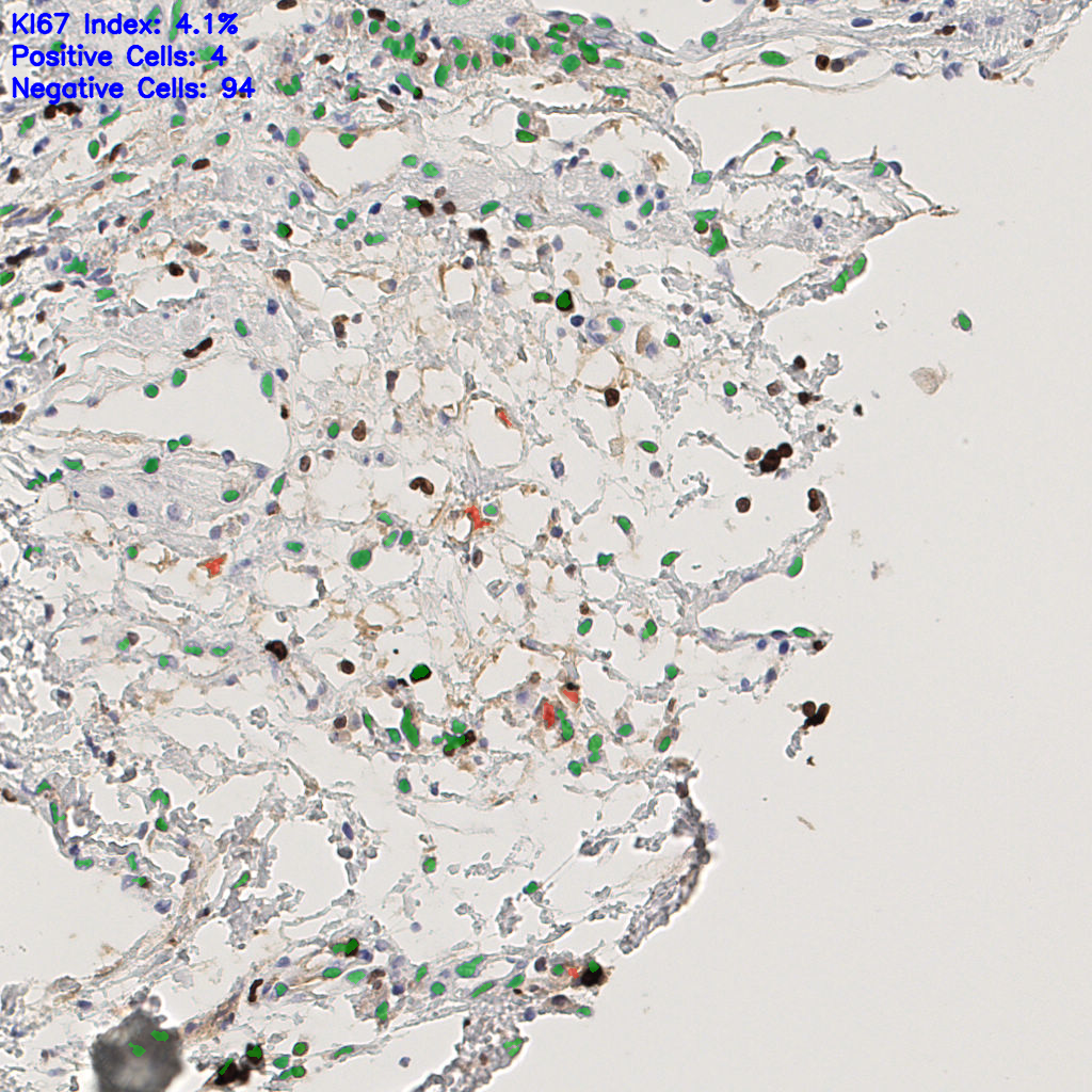 slice_46_10_x41216_y8960.png
