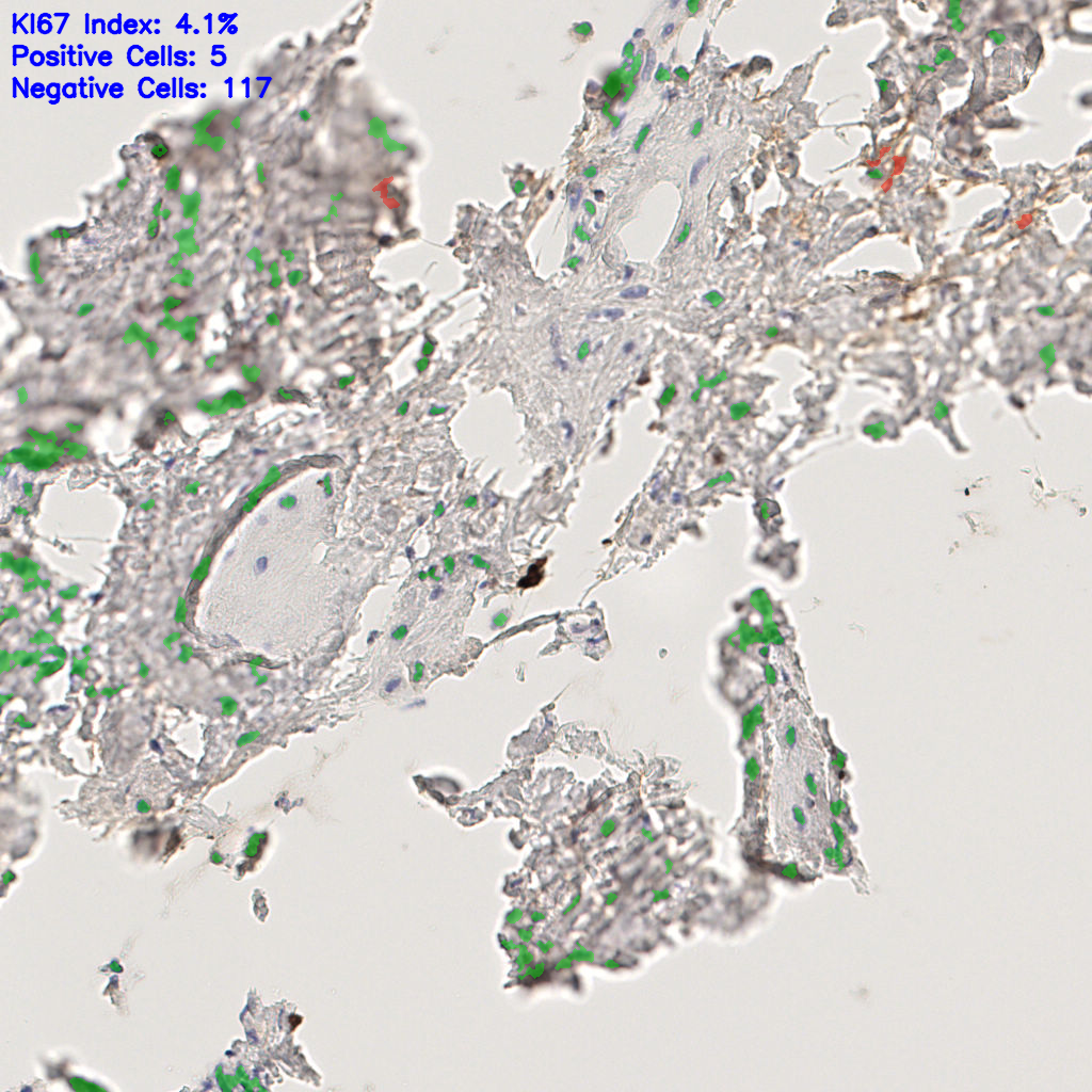 slice_46_14_x41216_y12544.png