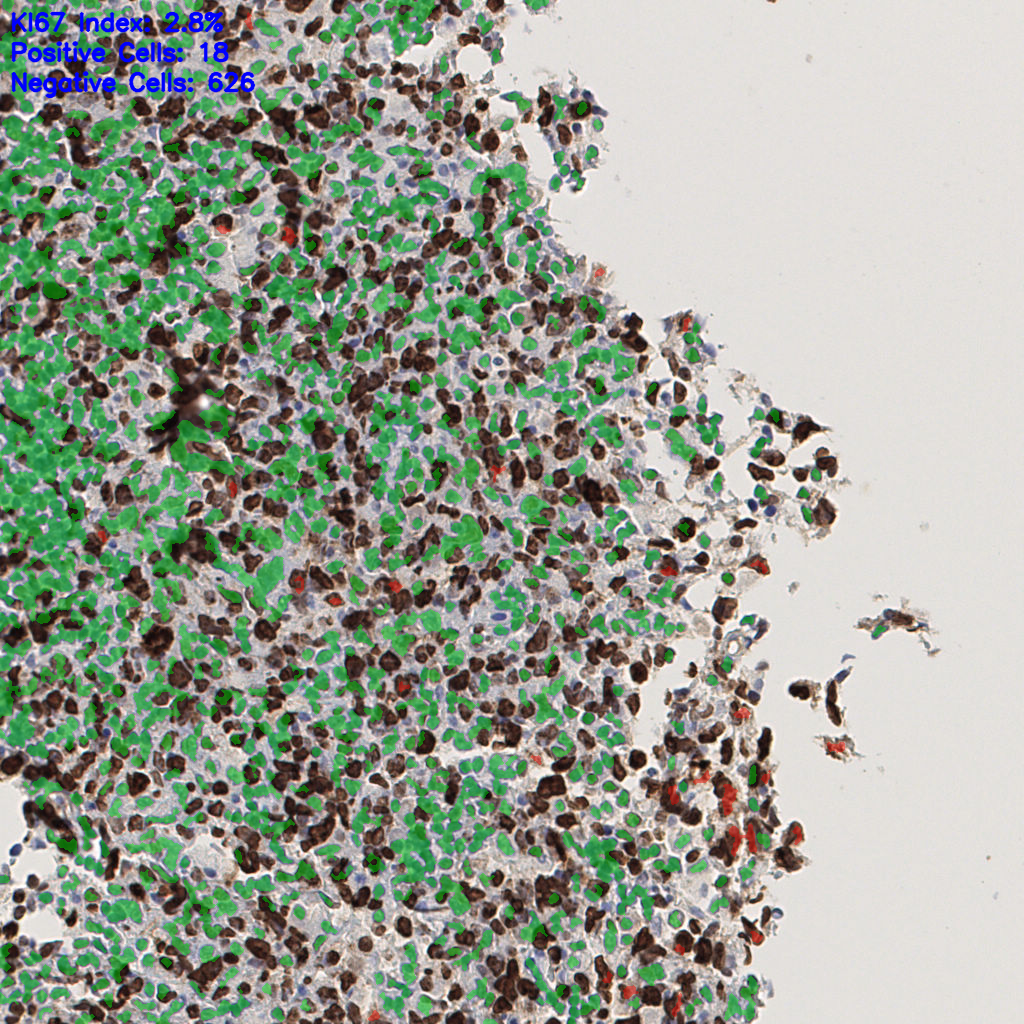 slice_46_5_x41216_y4480.png