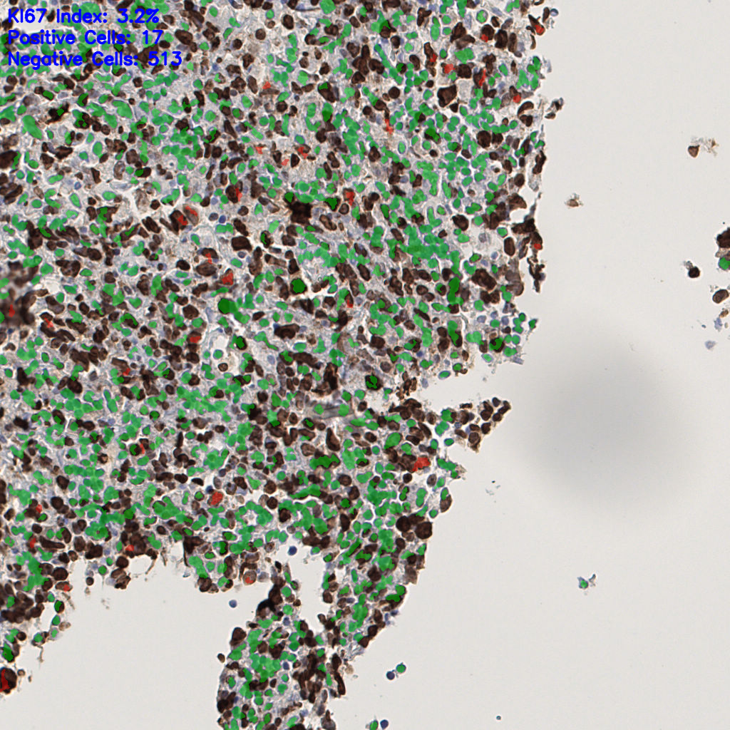 slice_46_6_x41216_y5376.png