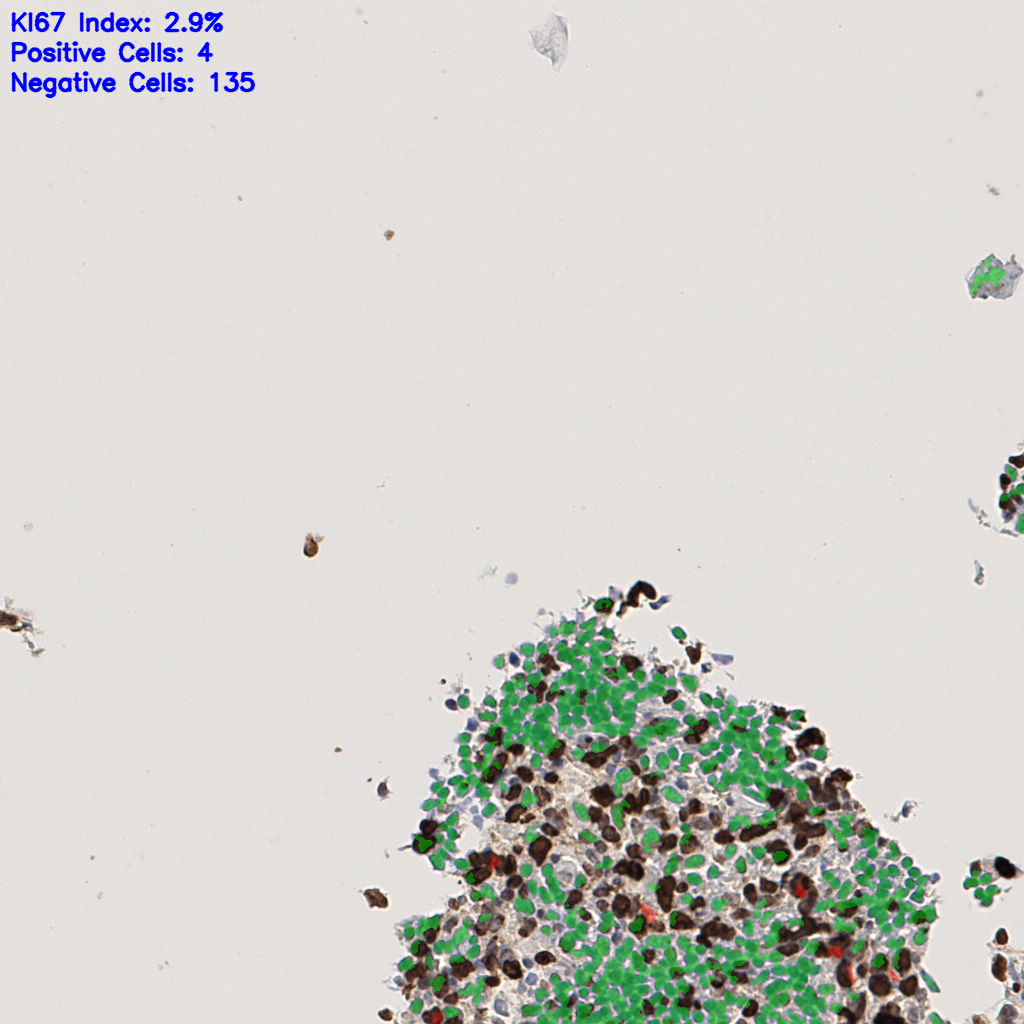 slice_47_5_x42112_y4480.png
