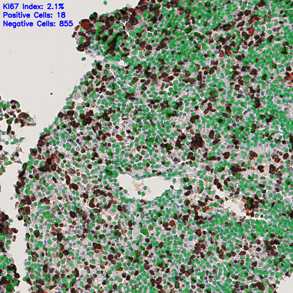 slice_47_7_x42112_y6272.png