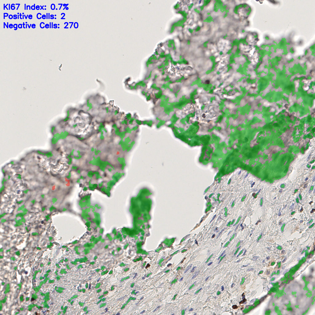 slice_48_12_x43008_y10752.png