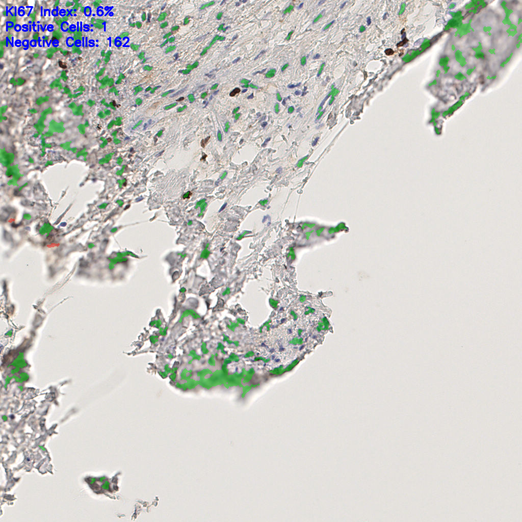 slice_48_13_x43008_y11648.png