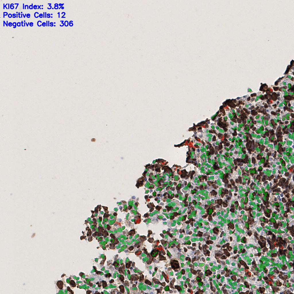 slice_48_4_x43008_y3584.png