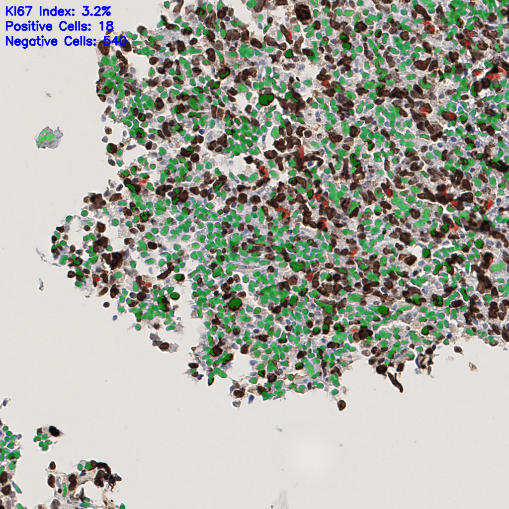 slice_48_5_x43008_y4480.png
