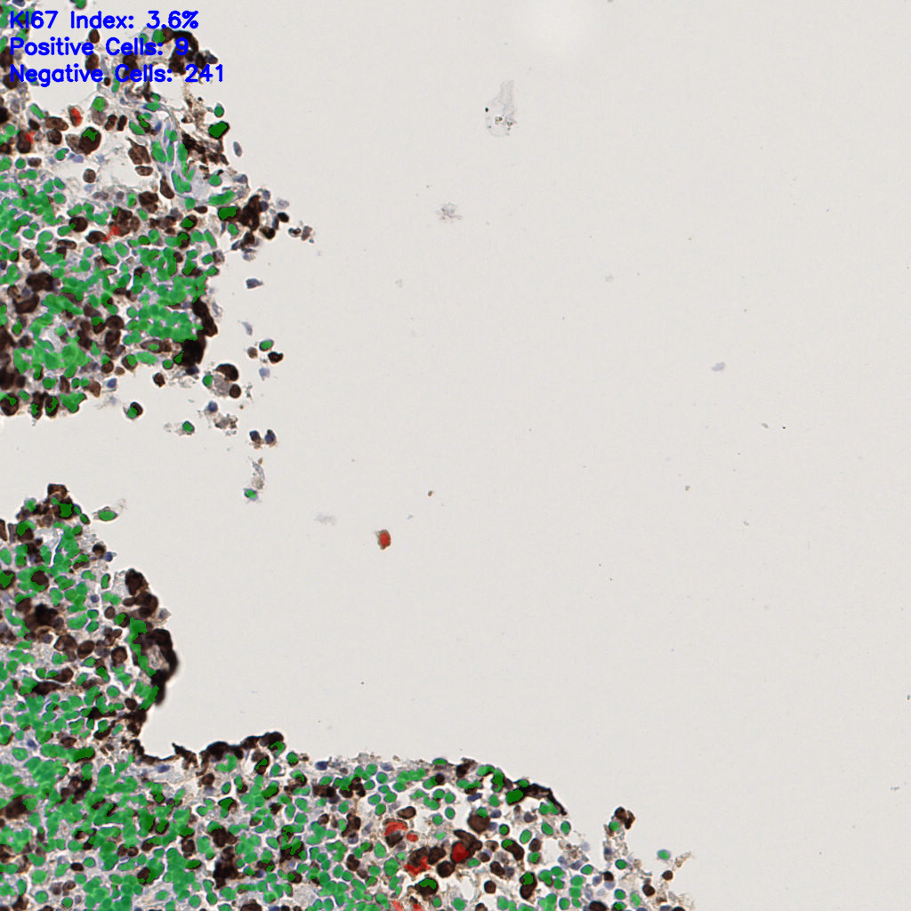 slice_48_6_x43008_y5376.png