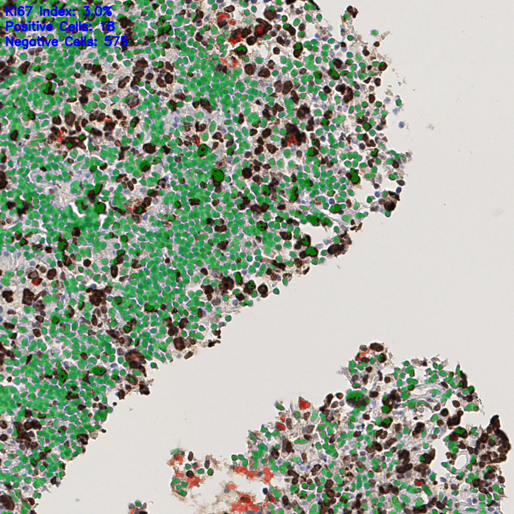 slice_48_7_x43008_y6272.png