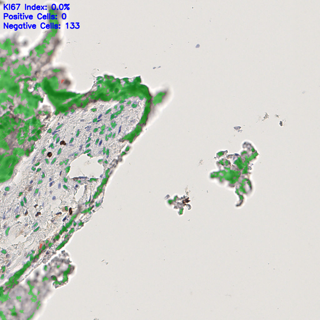 slice_49_12_x43904_y10752.png