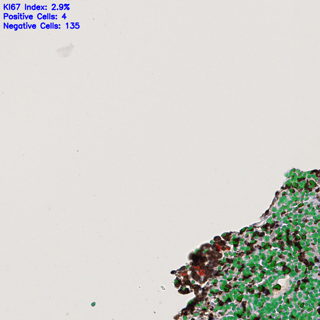 slice_49_3_x43904_y2688.png