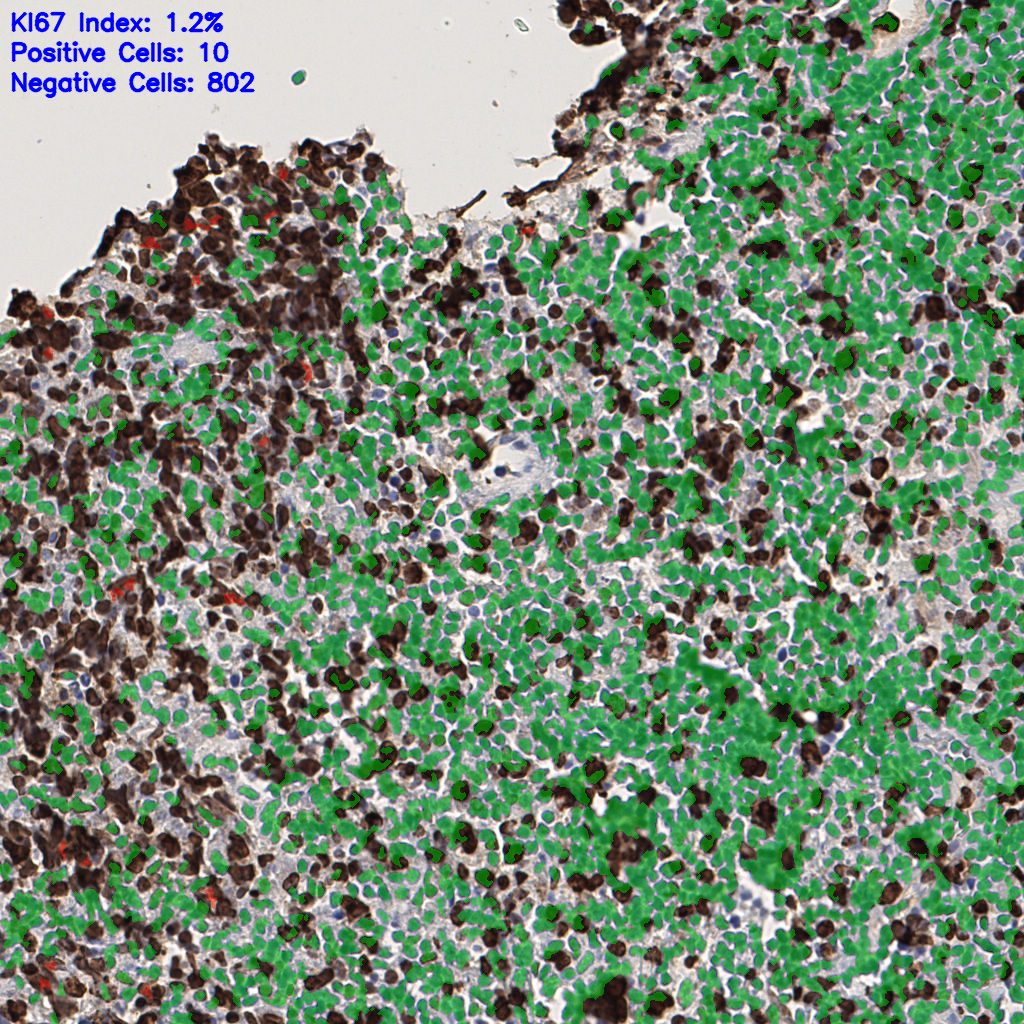 slice_49_4_x43904_y3584.png